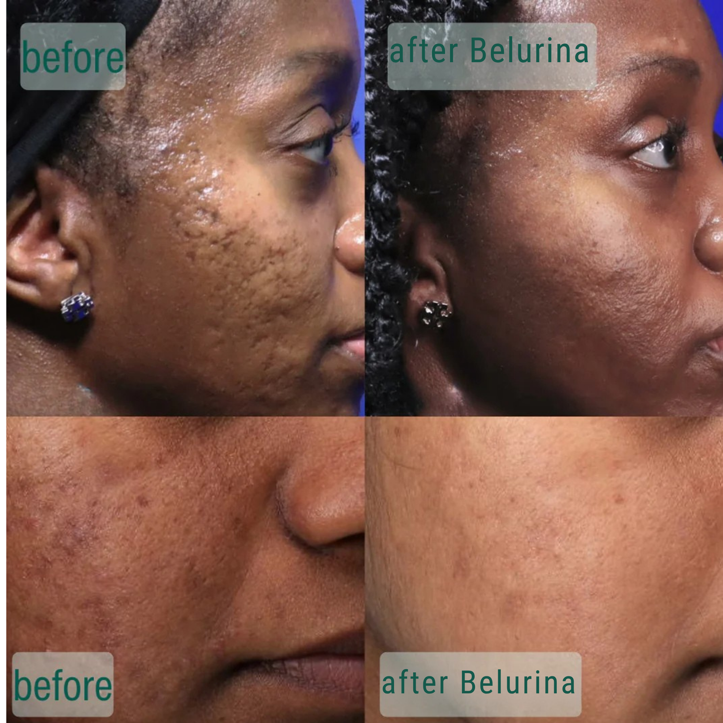 Microcrystal™ Serum PM Duo