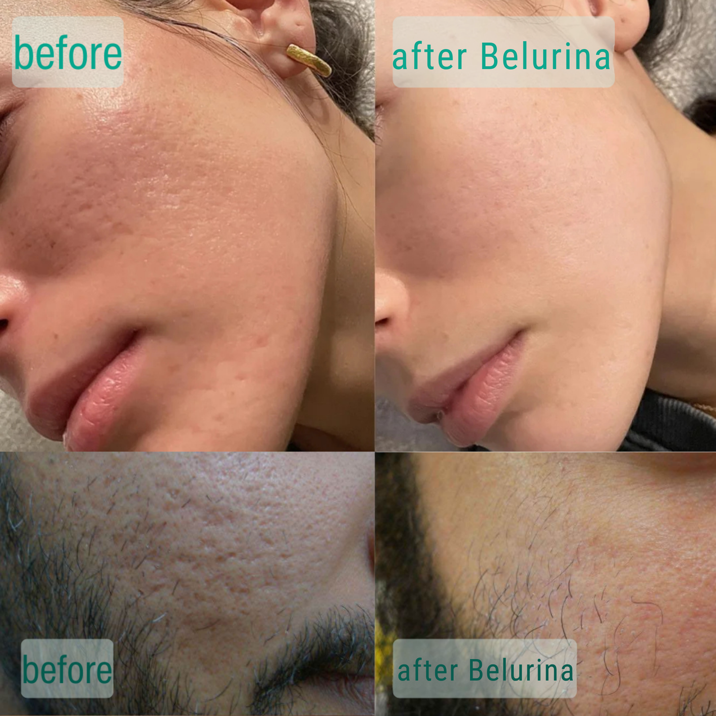 Microcrystal™ Serum PM Duo