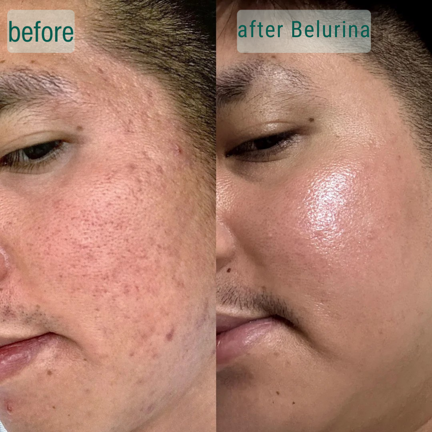 Microcrystal™ Serum PM Duo